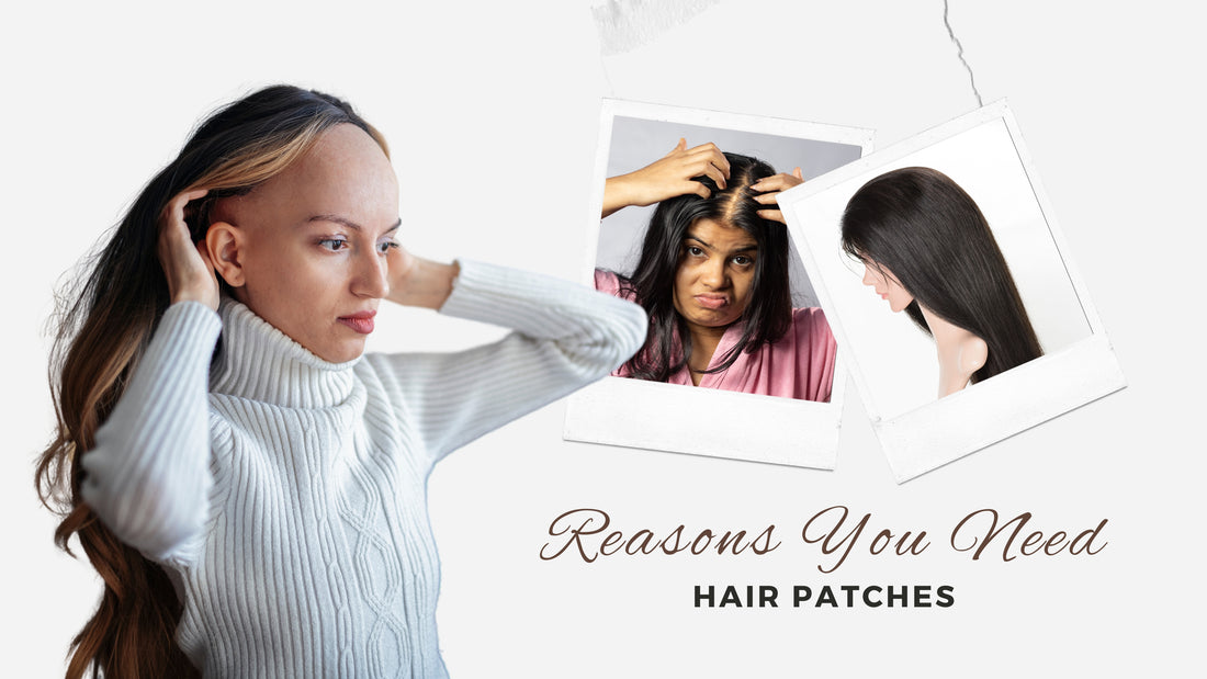 Reasons to use Hair Patches